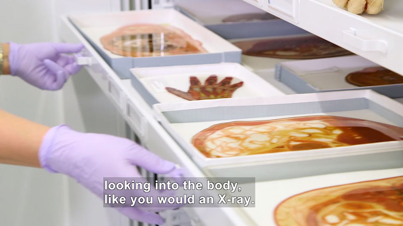 Drawer containing thin, preserved cross sections of the human body. Caption: looking into the body, like you would an x-ray.