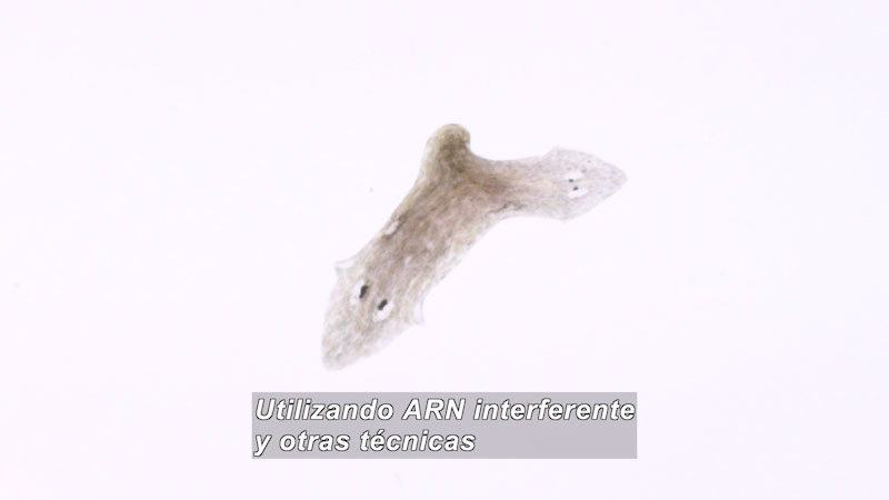 Microscopic view of an irregularly shaped organism. Spanish captions.