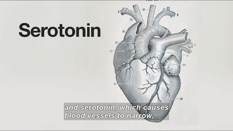 Illustration of the human heart. Caption: and serotonin, which causes blood vessels to narrow,