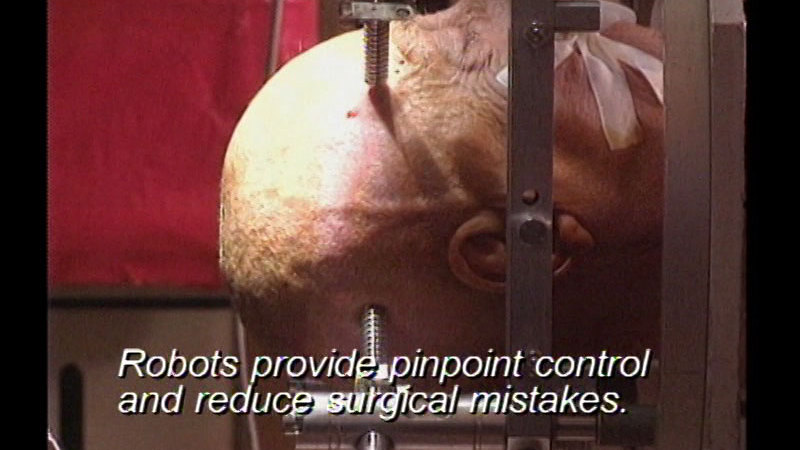 Still image from Medicine In The New Millennium