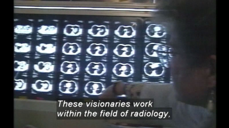 Still image from Radiologic Technology Careers: Nuclear Medicine