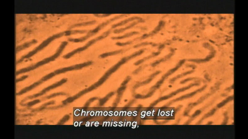 Microscopic view of cell structure. Caption: Chromosomes get lost or are missing,