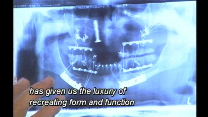 Still image from Reconstructive Surgery