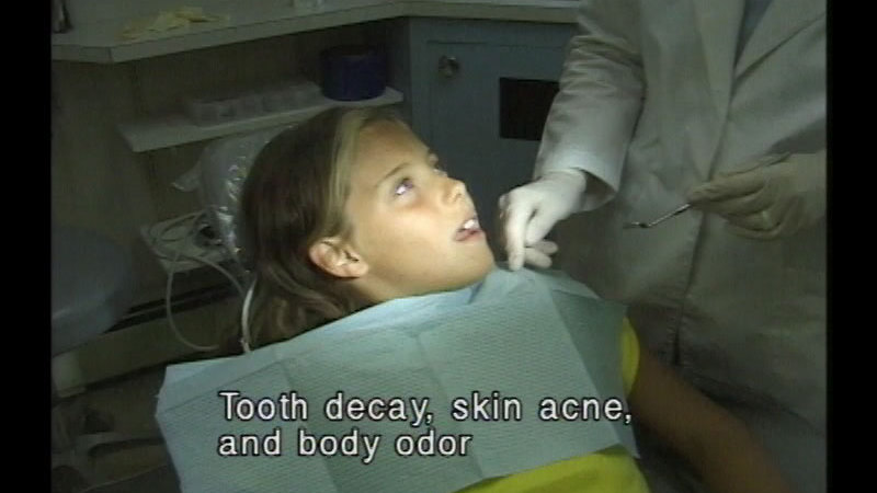 Young person in a dentist's chair. Caption: Tooth decay, skin acne, and body odor