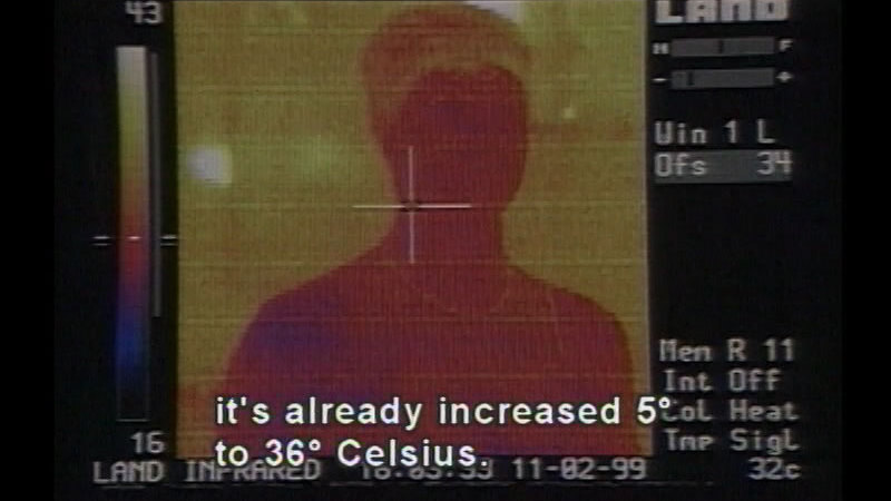 Infrared scan of the head and shoulders of a person mostly in red and yellow. Caption: it's already increased 5 degrees to 36 degrees Celsius.