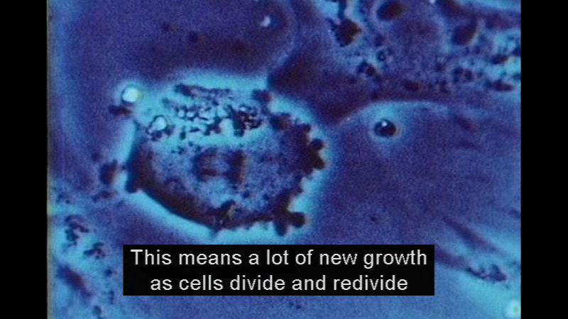 Microscopic view of a spherical cell in other structures. Caption: This means a lot of new growth as cells divide and redivide