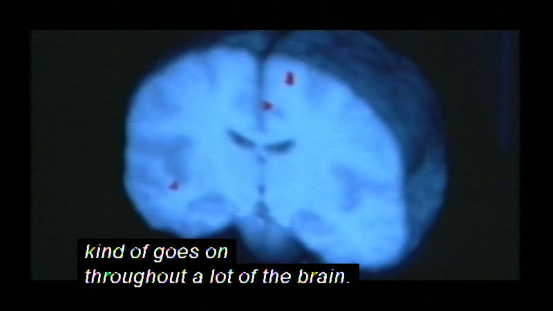 Still image from Reflexology