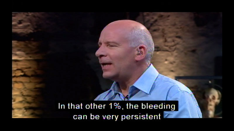 Person speaking. Caption: In that other 1%, the bleeding can be very persistent.