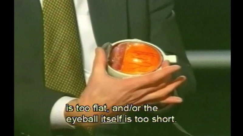 Still image from Second Opinion: Vision Correction