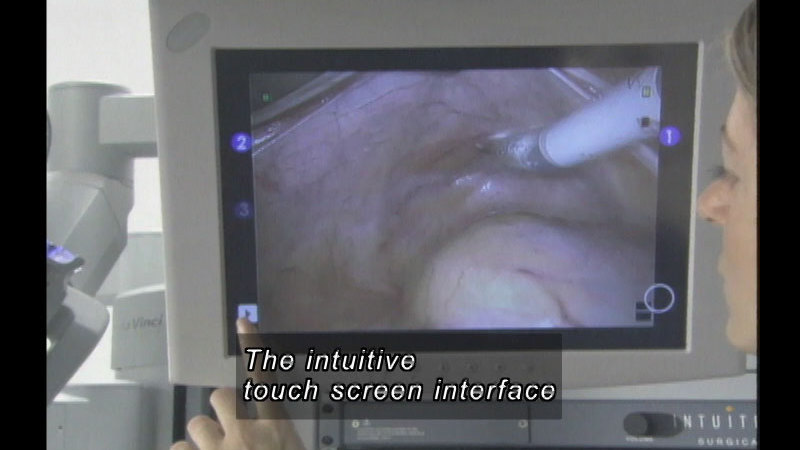 Person touching a screen displaying an image of live tissue. Caption: The intuitive touch screen interface