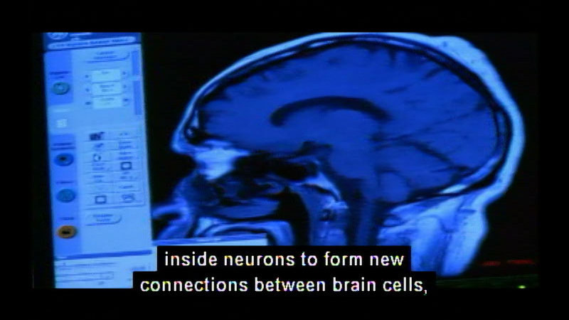 Computer screen showing cross section of a scan of the human brain. Caption: inside neurons to form new connections between brain cells,