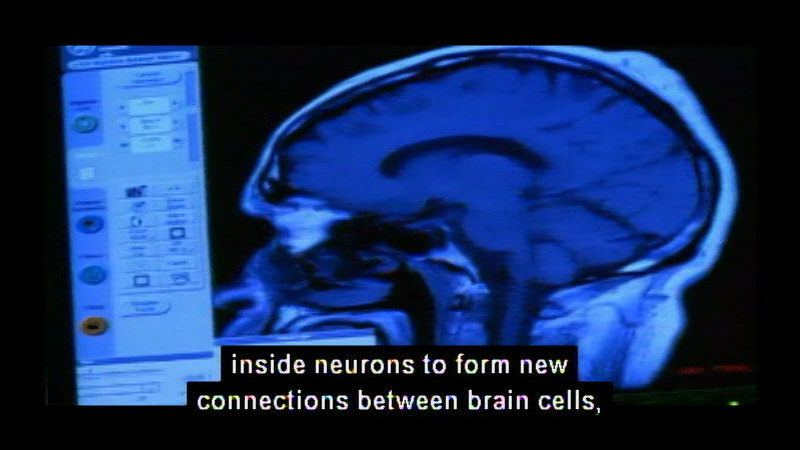 Still image from The Nature Of Things With David Suzuki: The Brain That Changes Itself