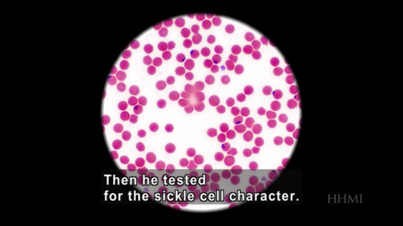 Magnified view of red, spherical objects. Caption: Then he tested for the sickle cell character.
