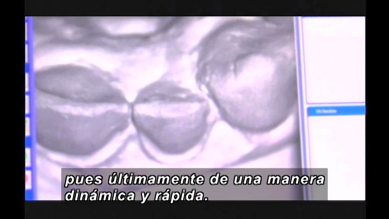 Dark and light grey structures against a white background. Spanish captions.
