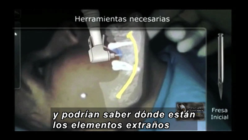 Computer simulation of a person practicing a dental procedure. Spanish captions.