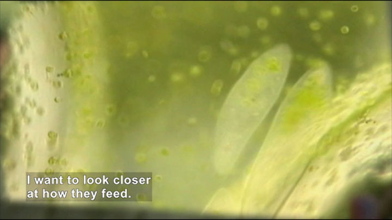 Microscopic view of roughly oval shaped organisms surrounded by much smaller green spherical objects. Caption: I want to look closer at how they feed.