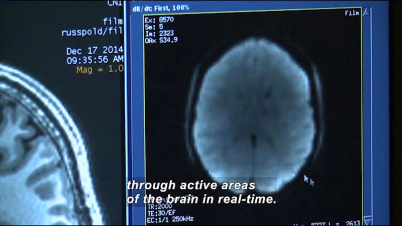 Computer screen showing the cross section of a human brain. Caption: through active areas of the brain in real-time.