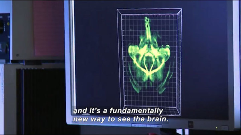 Computer screen showing a cross section of the human brain. Caption: and it's a fundamentally new way to see the brain.