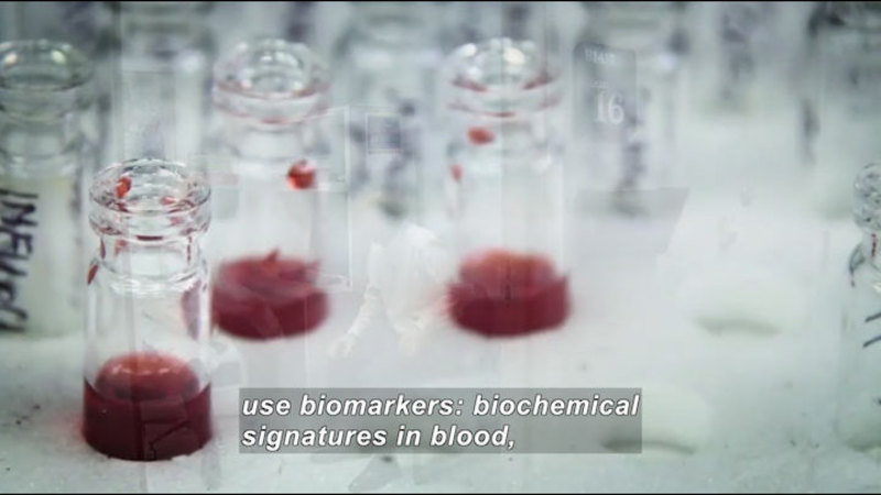 Test tubes of blood. Caption: use biomarkers: biochemical signatures in blood,