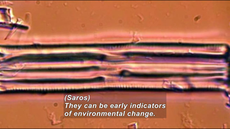 Microscopic view of tubular structures. Caption: (Saros) They can be early indicators of environmental change.