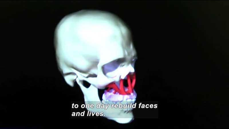 3D graphic of a human skull. Red latticework joins the area just under the eye sockets to the top of the jaw. Caption: to one day rebuild faces and lives.