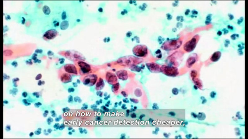 Microscopic view of cells. Some are blue and some are larger and red. Caption: on how to make early cancer detection cheaper.
