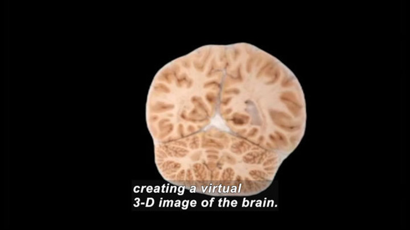 Cross section of the human brain. Caption: creating a virtual 3-D image of the brain.