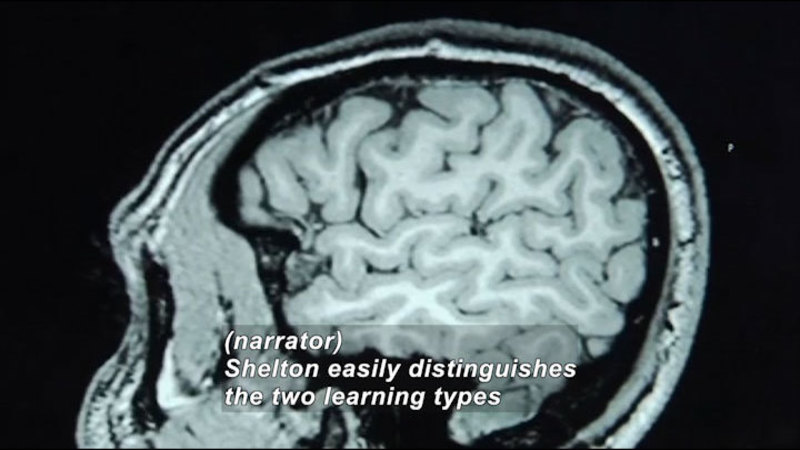 MRI cross section of the human brain. Caption: (narrator) Shelton easily distinguishes the two learning types