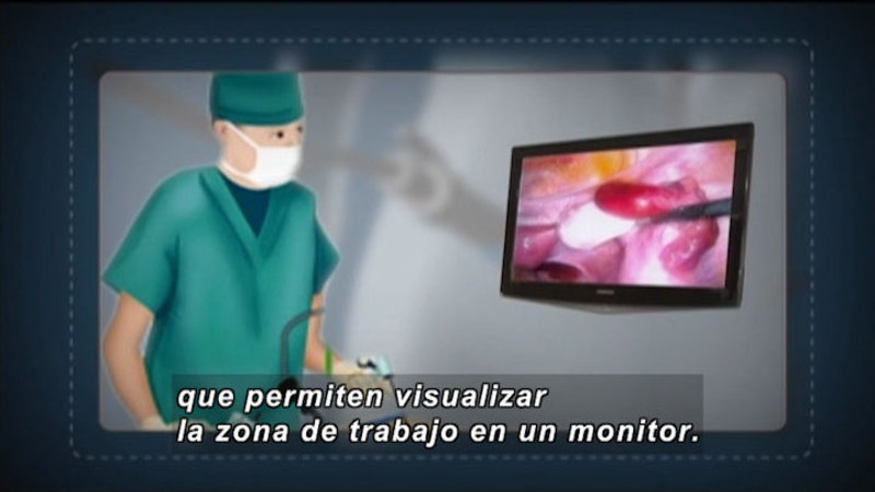 Illustration of a doctor with a mechanical device in their hand looking at an image on a monitor. Spanish captions.
