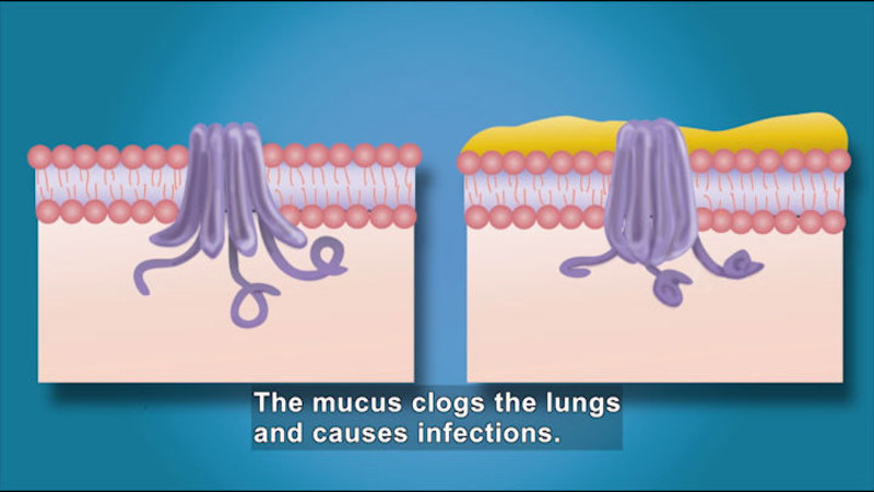 Diagram showing a lung structure with no mucus reaching into tissue below and the same lung structure covered in mucus unable to do the same thing. Caption: The mucus clogs the lungs and causes infections.