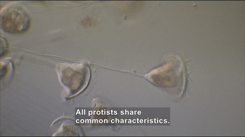 Microscopic view of bell-shaped organisms on a fine stalk. Caption: All protists share common characteristics.