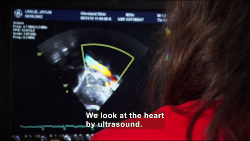 Still image from Career Connections: Sonographer
