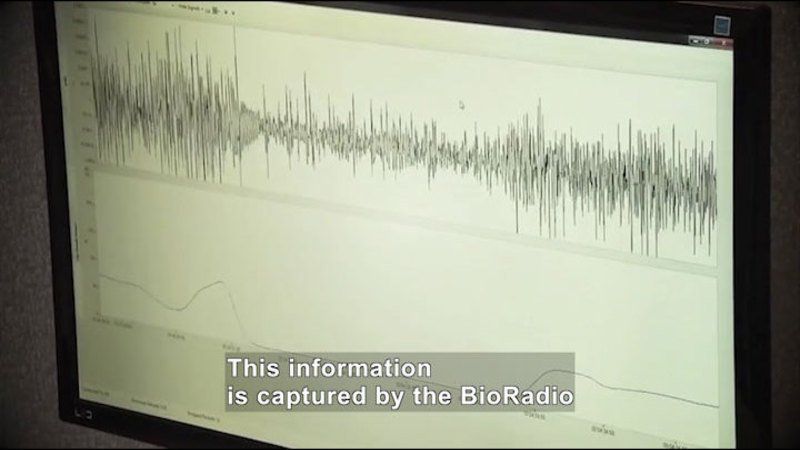 Two-line graphs. One with sharp, jagged, closely spaced peaks and valleys, the other with more gently increasing and decreasing peaks and valleys. Caption: This information is captured by the BioRadio