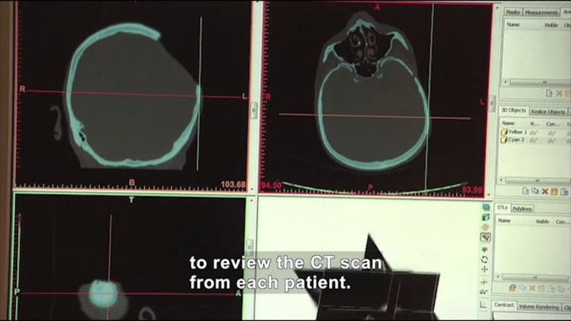 Still image from Career Connections: Prosthetic Specialist